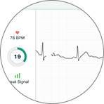 Omron Complete™ Wireless Upper Arm Blood Pressure Plus EKG Monitor – Save  Rite Medical