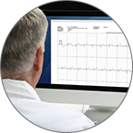 Blood pressure monitor OMRON COMPLETE ECG 2 В 1